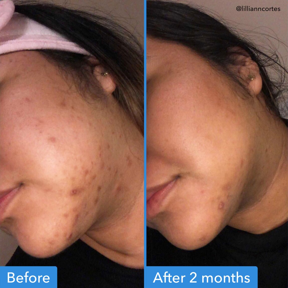discoloration-correcting-serum-p2 zb_p.jpg