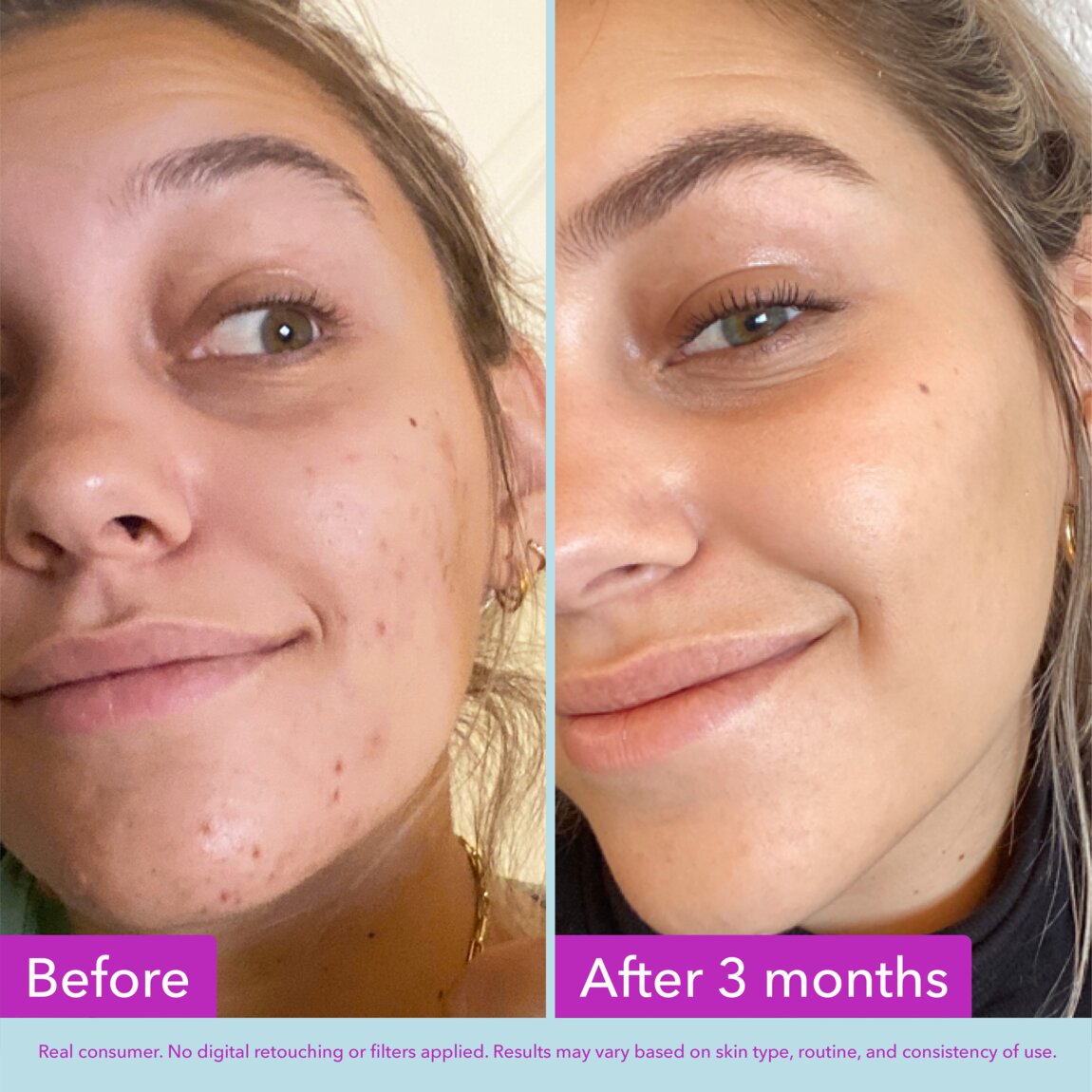 niacinamide-brightening-toner-y5 zb_p.jpg