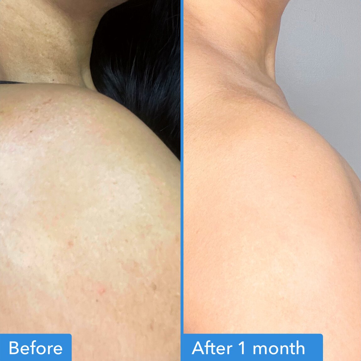 discoloration-correcting-body-treatment-g1 zb_p.jpg